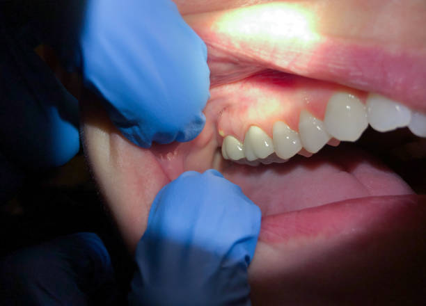 Best Emergency Cosmetic Dentistry in Elizabethville, PA