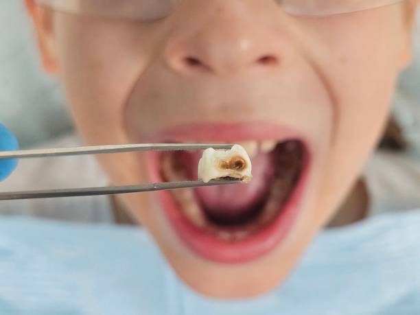 Best Emergency Dental Services for Seniors in Elizabethville, PA